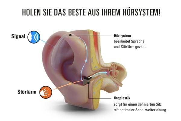 hoerlux-otoplastik-rottler